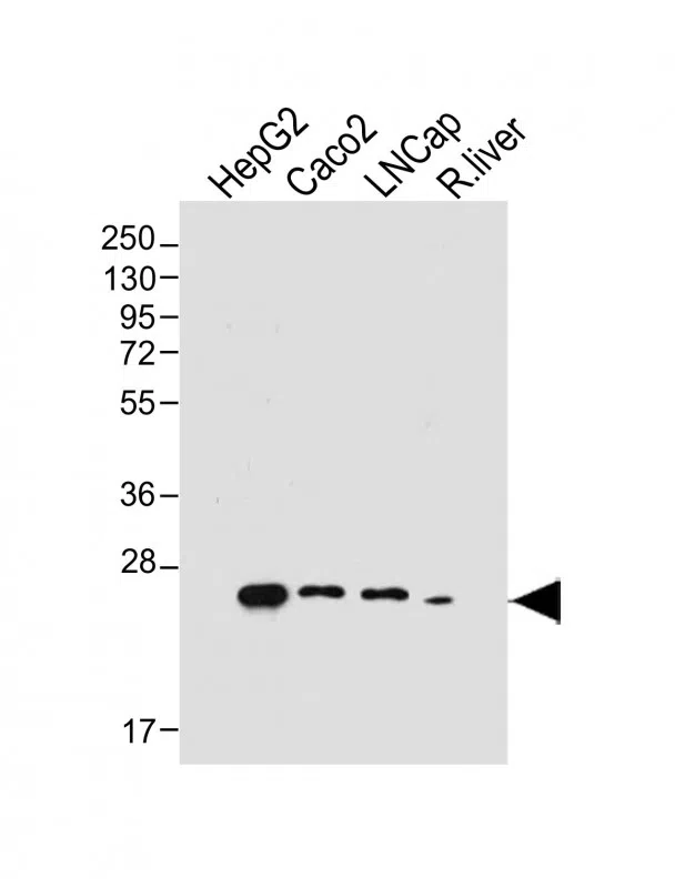 GSTA1 Mouse Monoclonal Antibody - Size: 50µl