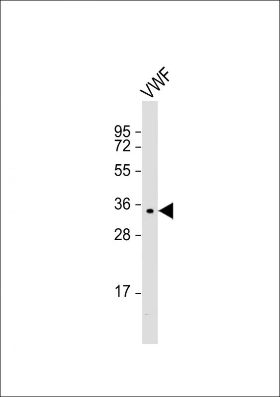 VWF Mouse Monoclonal Antibody - Size: 100µl
