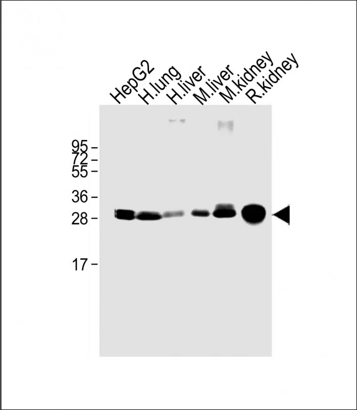SULT1A1 Mouse Monoclonal Antibody - Size: 50µl