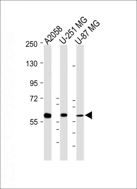 MMP14 Mouse Monoclonal Antibody - Size: 100µl