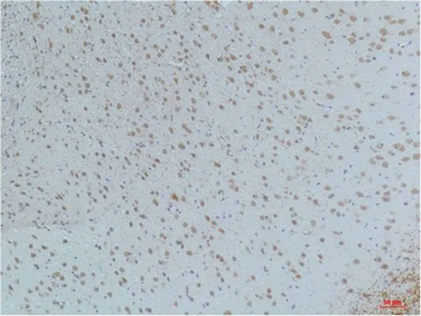 CaMKIIß/?/d(Phospho Thr287)(4H2) Mouse Monoclonal Antibody - Size: 50µl