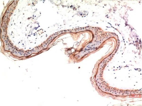 phospho-MLKL (S358) Mouse(6F8) Mouse Monoclonal Antibody - Size: 100µl