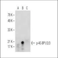 4E-BP1/2/3 (Phospho-Thr 45) Mouse Monoclonal Antibody - Size: 50µl