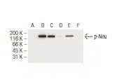 HER2 / ErbB2 (Phospho-Thr 686) Mouse Monoclonal Antibody - Size: 50µl