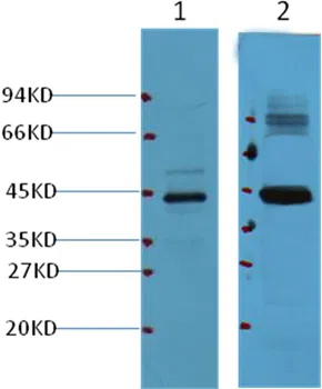 AMACR/P504S Mouse Mouse Monoclonal Antibody - Size: 100µl