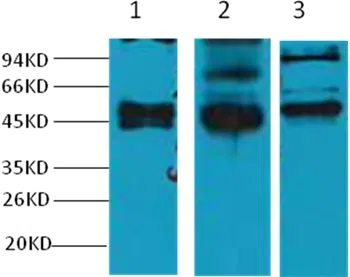 CK17 Mouse Mouse Monoclonal Antibody - Size: 100µl