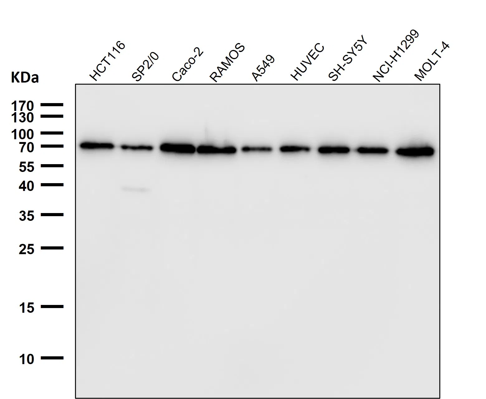Lamin B1 Rabbit Monoclonal Antibody - Size: 100µl