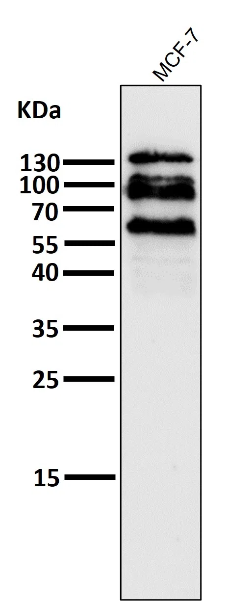 ECadherin Rabbit Monoclonal Antibody - Size: 100µl