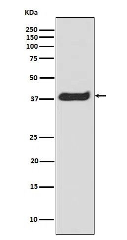 Phospho-LAT(Y191) Rabbit Monoclonal Antibody - Size: 100µl