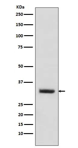 C10orf63 Rabbit Monoclonal Antibody - Size: 100µl