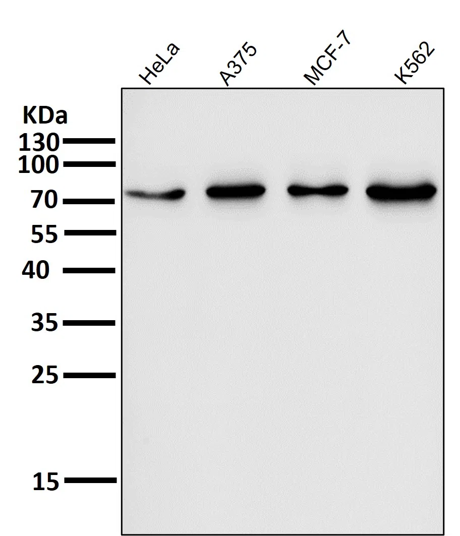 FOXO3A Rabbit Monoclonal Antibody - Size: 100µl