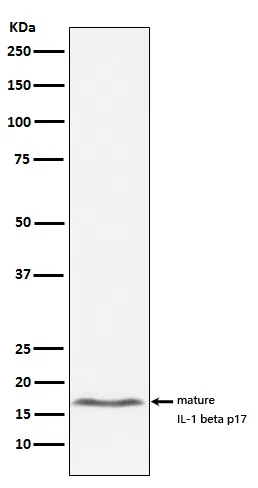 IL1 beta Rabbit Monoclonal Antibody - Size: 100µl