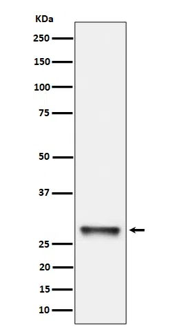 PNMT Rabbit Monoclonal Antibody