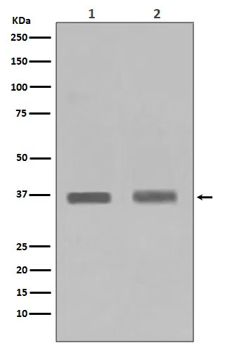 PPP1CA+1CB Rabbit Monoclonal Antibody - Size: 50µl
