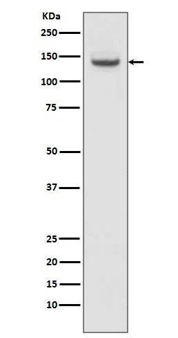 TACC3 Rabbit Monoclonal Antibody - Size: 100µl