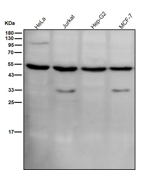 Phospho-MLKL(S345) Rabbit Monoclonal Antibody - Size: 50µl