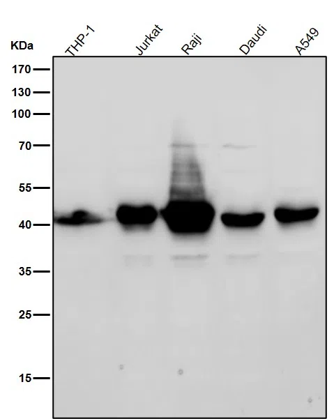 MHC classI Rabbit Monoclonal Antibody - Size: 100µl