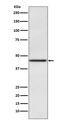Pax2 Rabbit Monoclonal Antibody - Size: 50µl
