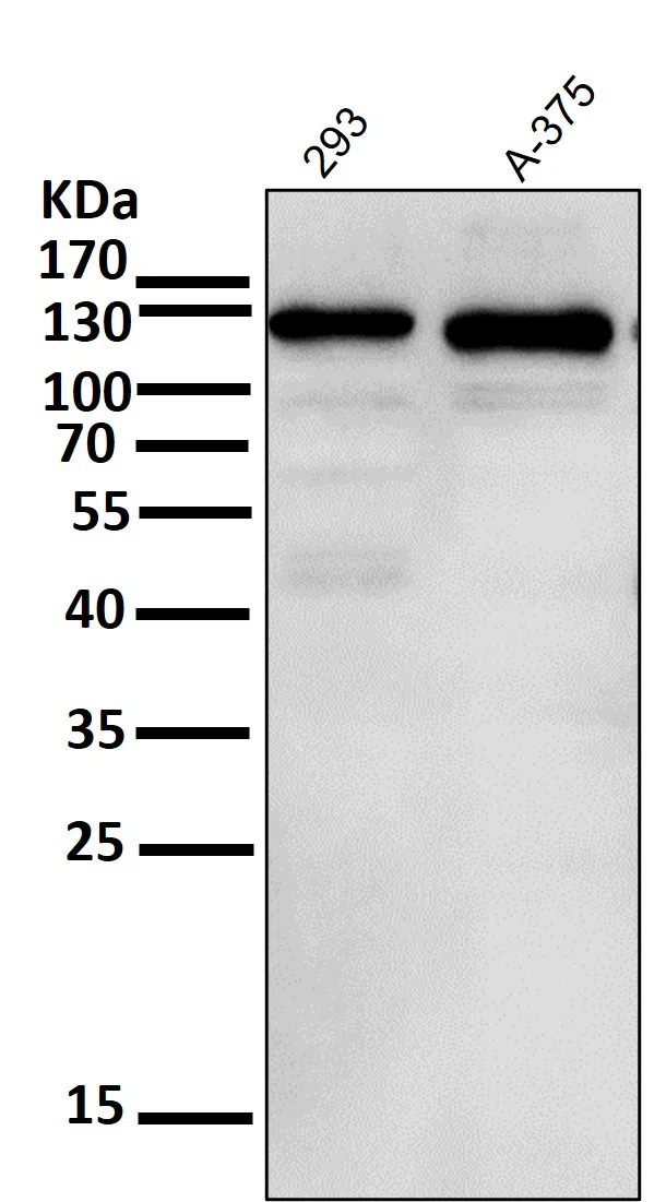 Notch 1 Rabbit Monoclonal Antibody - Size: 50µl