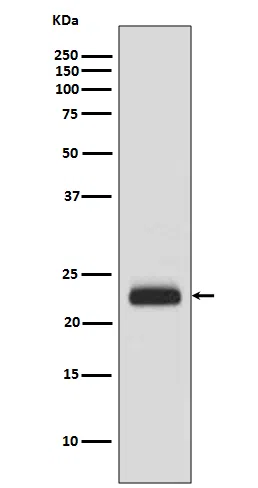 RAIDD Rabbit Monoclonal Antibody - Size: 100µl