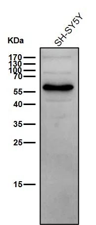 TCF3 Rabbit Monoclonal Antibody - Size: 100µl