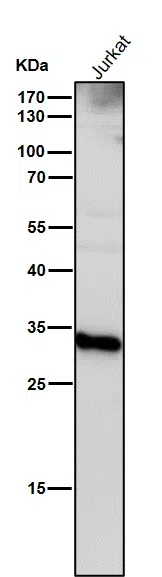Cathepsin D Rabbit Monoclonal Antibody - Size: 100µl