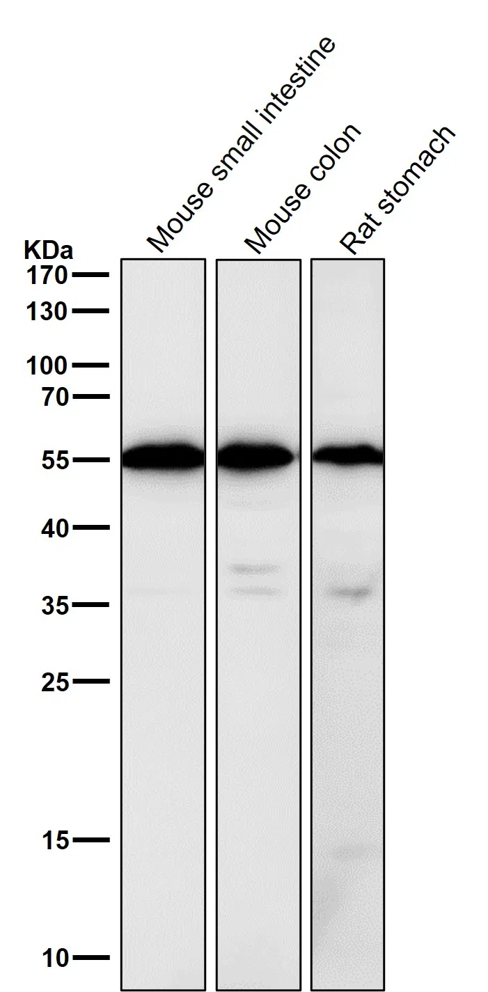 Calreticulin Rabbit Monoclonal Antibody - Size: 50µl