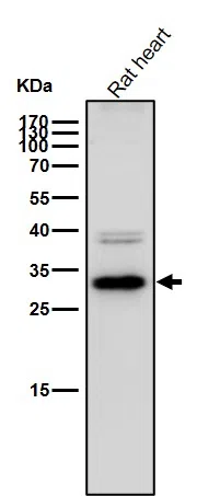 CBR1 Rabbit Monoclonal Antibody - Size: 50µl