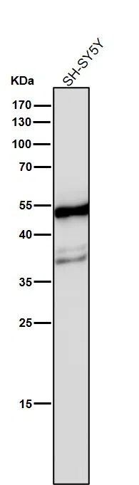 beta II Tubulin Rabbit Monoclonal Antibody - Size: 100µl