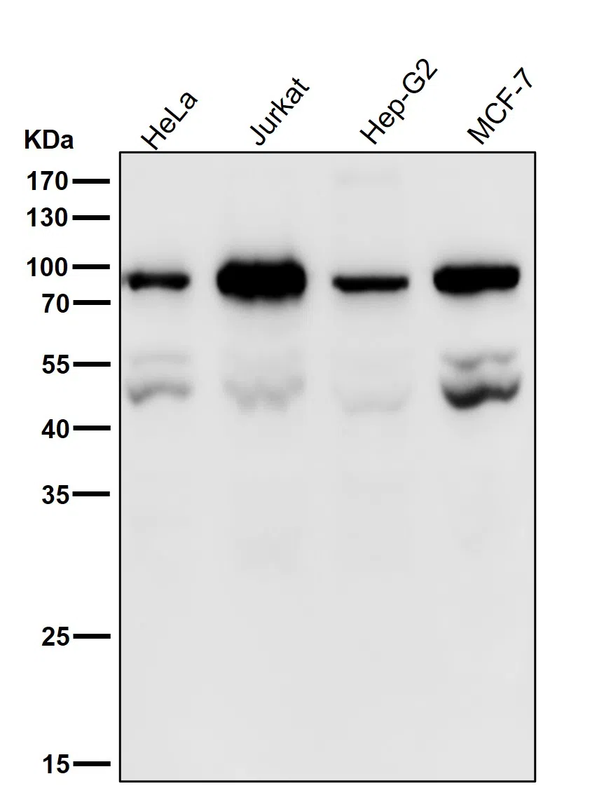 PSIP1/LEDGF Rabbit Monoclonal Antibody - Size: 100µl