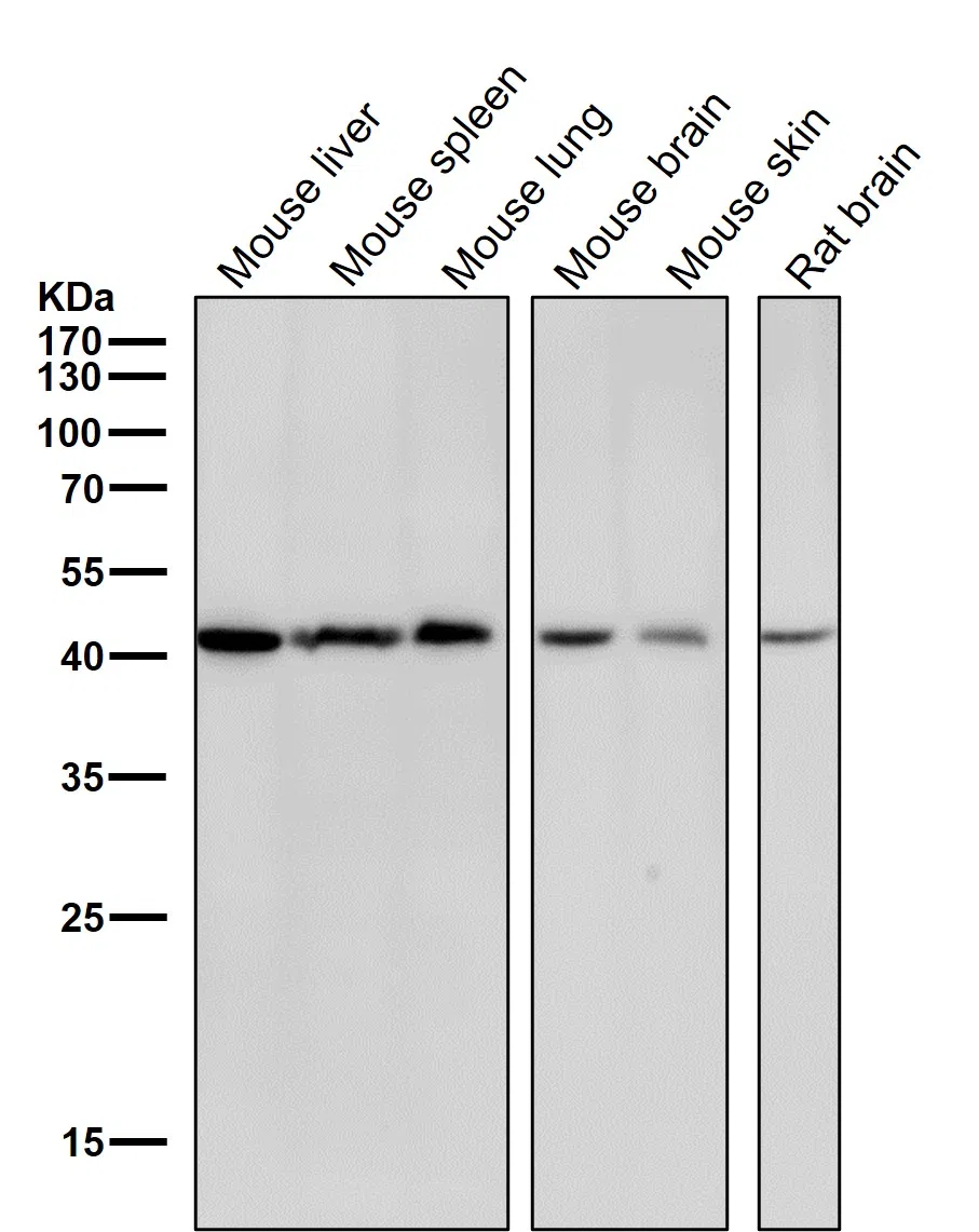 CABP Rabbit Monoclonal Antibody
