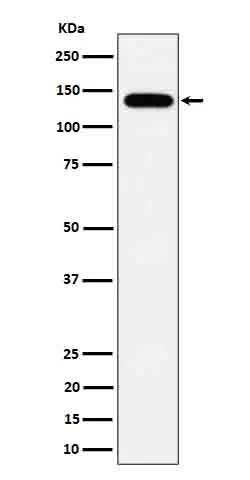 Tripeptidyl peptidase 2 Rabbit Monoclonal Antibody - Size: 100µl