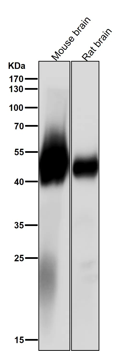 Acetyl-alpha Tubulin(Lys40) Rabbit Monoclonal Antibody - Size: 50µl