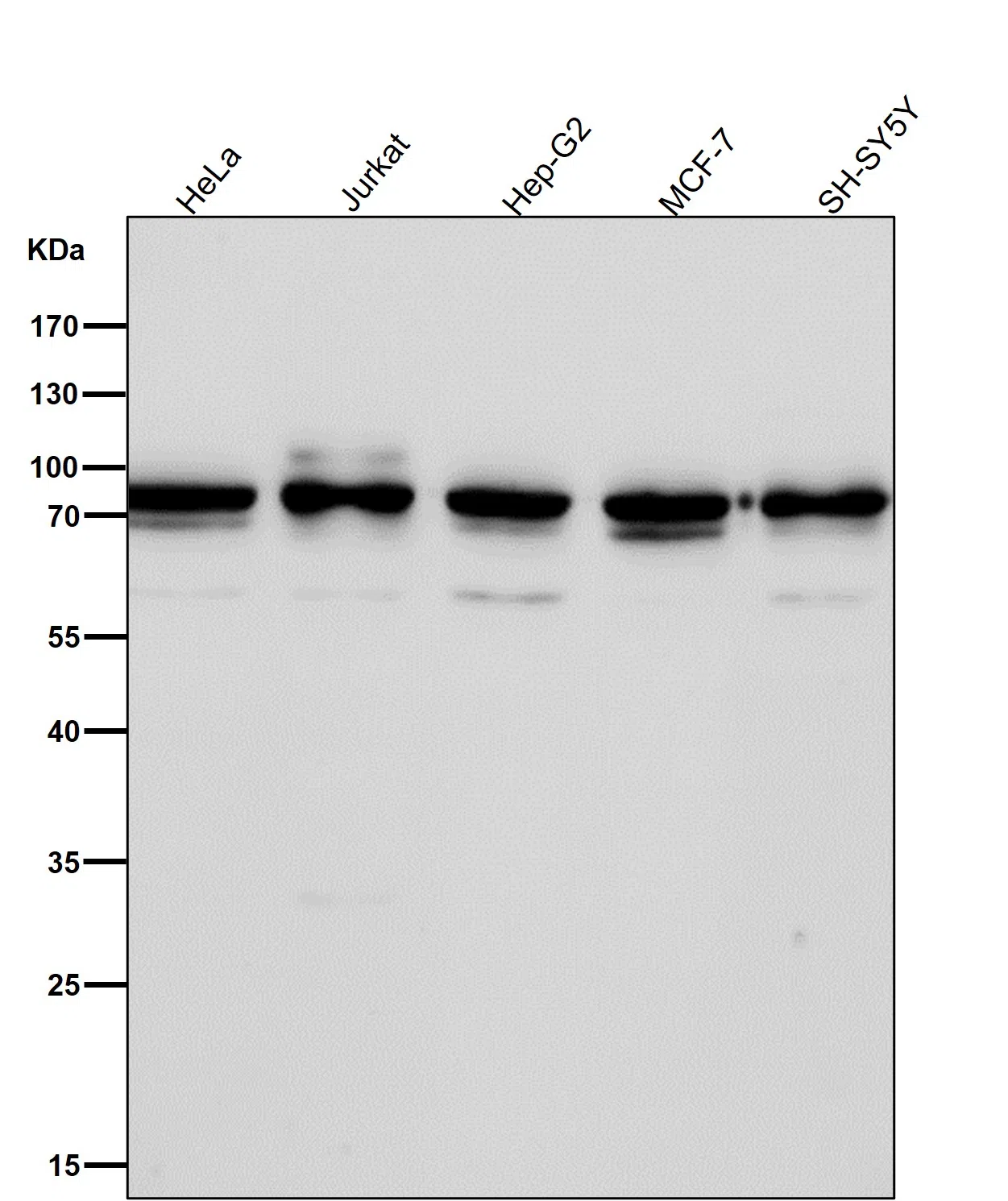 Apc6/CDC16 Rabbit Monoclonal Antibody - Size: 100µl