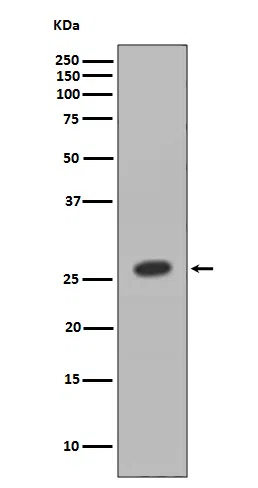 HOXB9 Rabbit Monoclonal Antibody - Size: 100µl