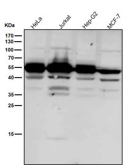 Caspase 2 Rabbit Monoclonal Antibody - Size: 50µl