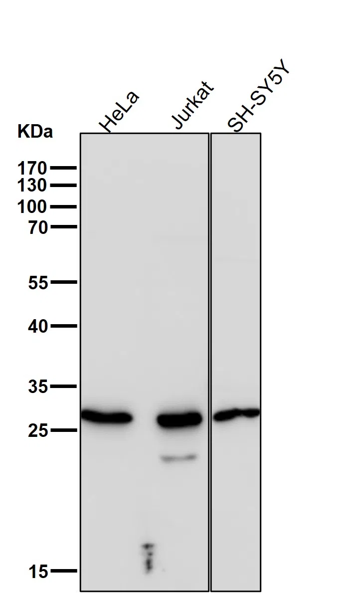 RPS3 Rabbit Monoclonal Antibody - Size: 50µl