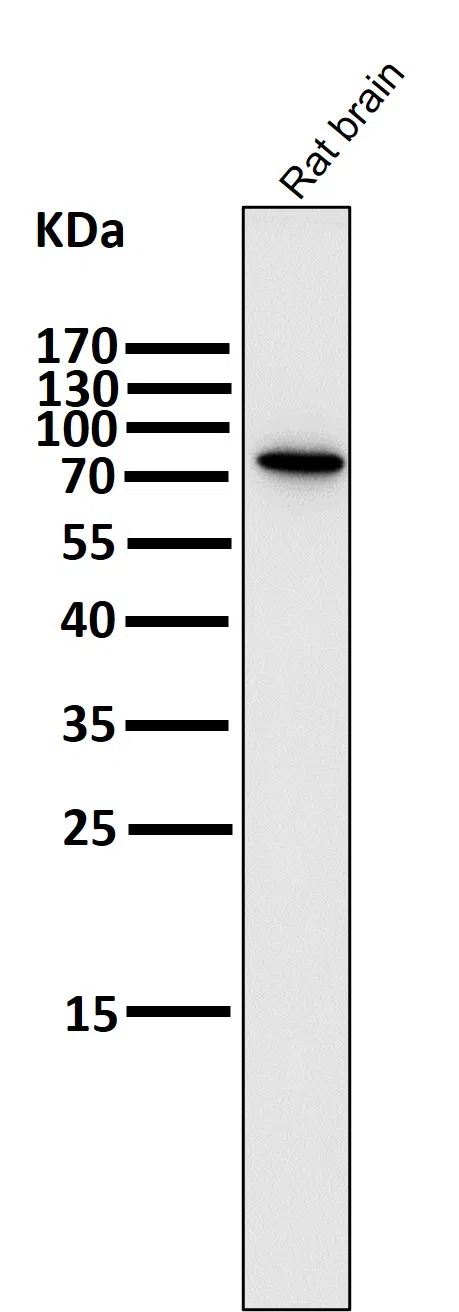 PI3 Kinase p85 beta Rabbit Monoclonal Antibody - Size: 100µl