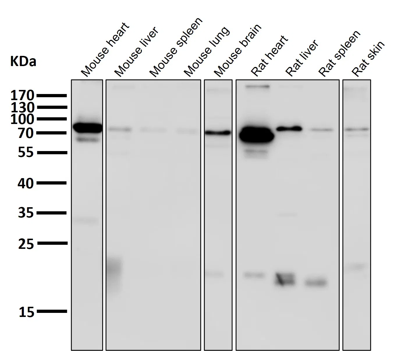 HIF-1beta Rabbit Monoclonal Antibody - Size: 100µl