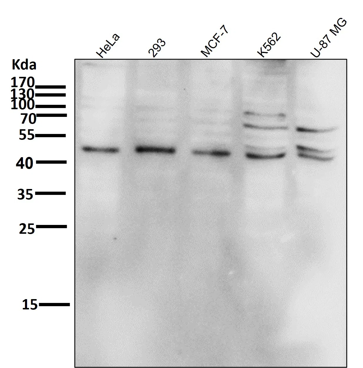 Phospho-JNK1/2/3(T183+T183+T221) Rabbit Monoclonal Antibody - Size: 50µl