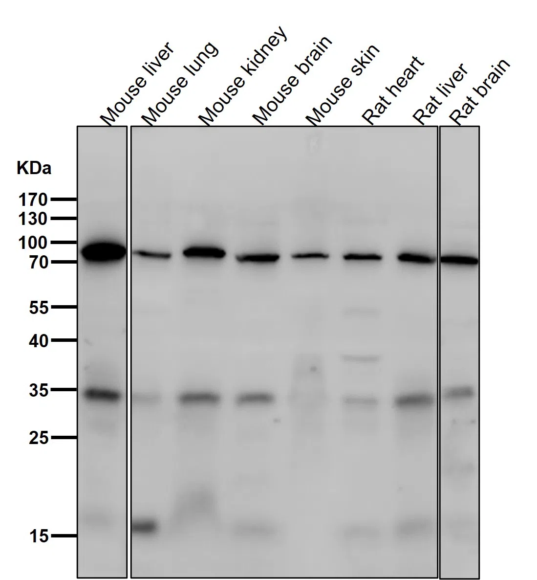 Phospho-FOXO3a(S253) Rabbit Monoclonal Antibody - Size: 50µl