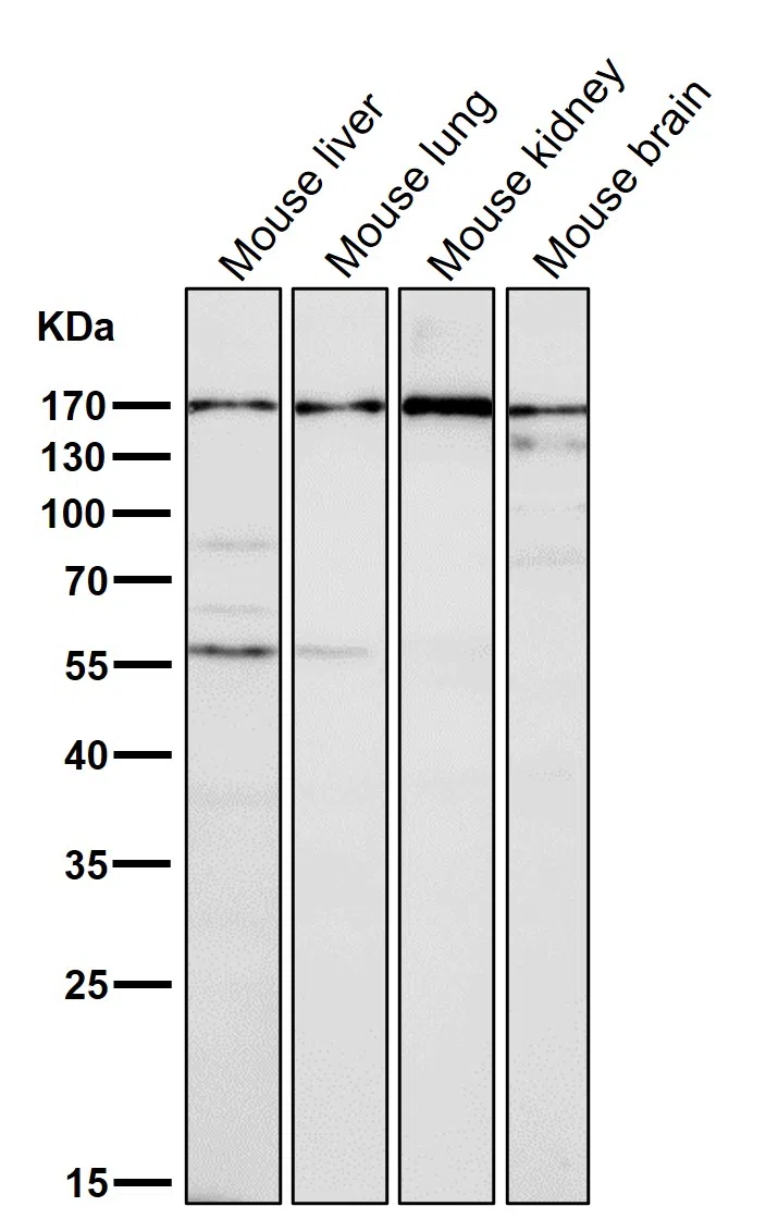 EEA1 Rabbit Monoclonal Antibody