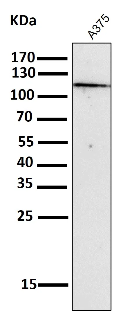 NALP3 Rabbit Monoclonal Antibody - Size: 100µl