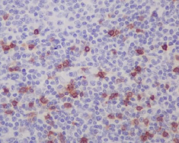 Integrin alpha E Rabbit Monoclonal Antibody - Size: 100µl