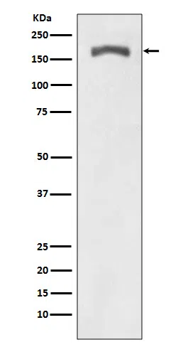 Phospho-PDGF Receptor beta(Y740) Rabbit Monoclonal Antibody - Size: 50µl