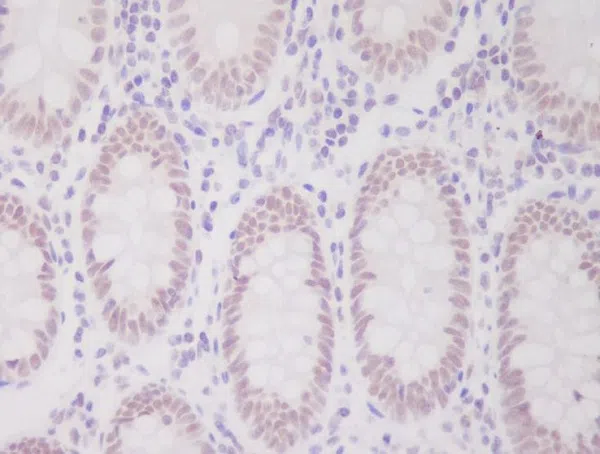 Immunohistochemistry(IHC) - hnRNP C1/C2 Rabbit Monoclonal Antibody AMRe83809