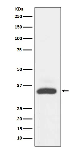 MAD2L1 binding protein Rabbit Monoclonal Antibody - Size: 50µl