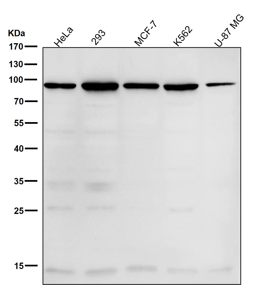 WASF2 Rabbit Monoclonal Antibody - Size: 50µl