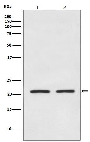 AKAP14 Rabbit Monoclonal Antibody - Size: 100µl