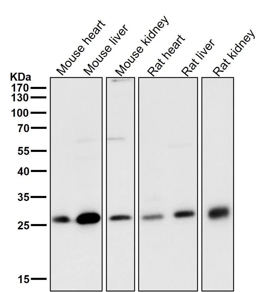 NQO2 Rabbit Monoclonal Antibody - Size: 100µl